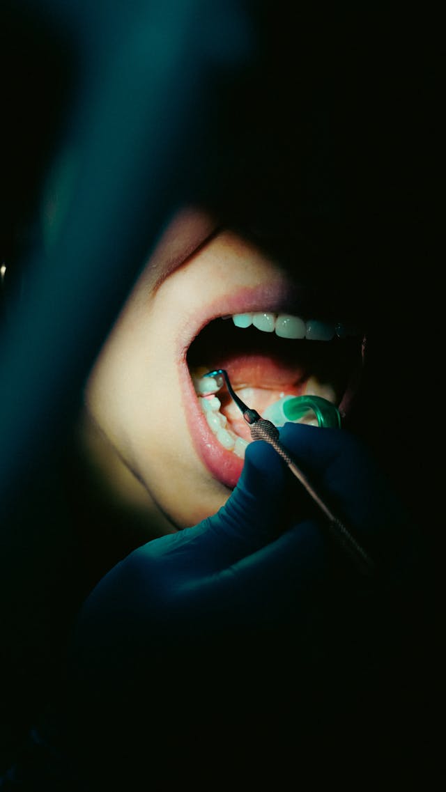 Czy piaskowanie zębów usuwa kamień nazębny?